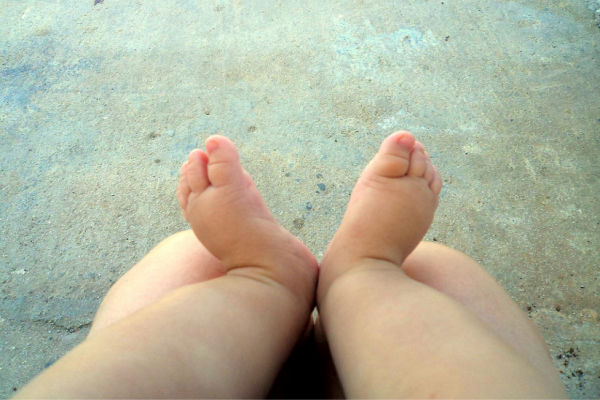 Atopijski dermatitis